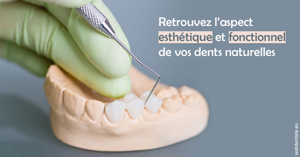 https://dr-bensoussan-jacques-yves.chirurgiens-dentistes.fr/Restaurations dentaires 1