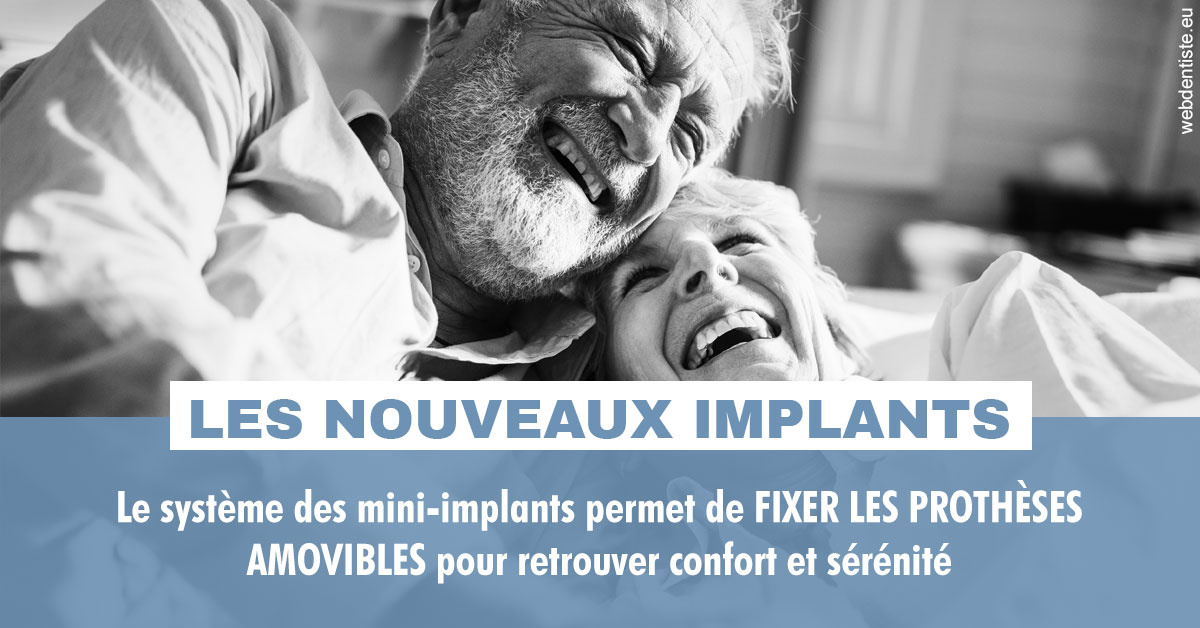https://dr-bensoussan-jacques-yves.chirurgiens-dentistes.fr/Les nouveaux implants 2