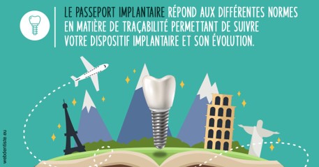 https://dr-bensoussan-jacques-yves.chirurgiens-dentistes.fr/Le passeport implantaire