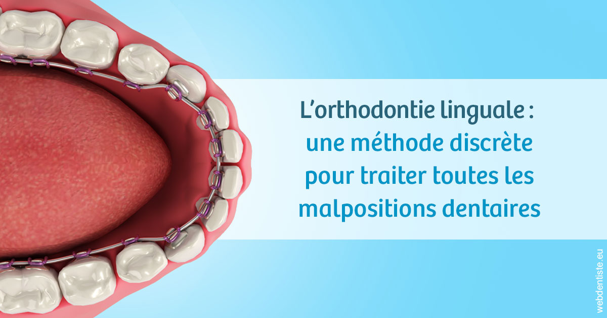 https://dr-bensoussan-jacques-yves.chirurgiens-dentistes.fr/L'orthodontie linguale 1
