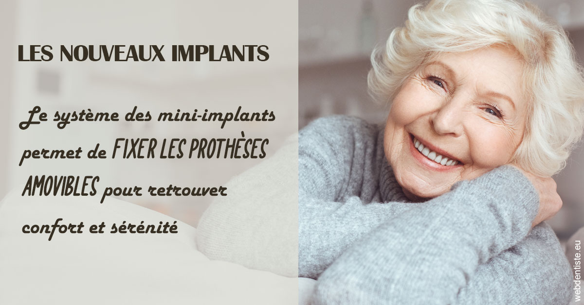 https://dr-bensoussan-jacques-yves.chirurgiens-dentistes.fr/Les nouveaux implants 1