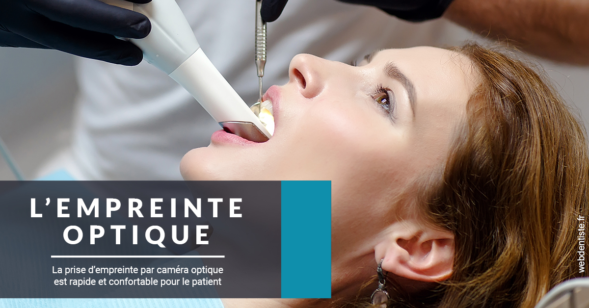 https://dr-bensoussan-jacques-yves.chirurgiens-dentistes.fr/L'empreinte Optique 1
