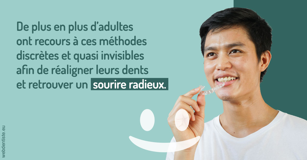 https://dr-bensoussan-jacques-yves.chirurgiens-dentistes.fr/Gouttières sourire radieux 2