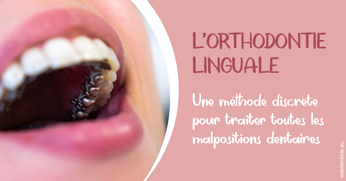 https://dr-bensoussan-jacques-yves.chirurgiens-dentistes.fr/L'orthodontie linguale 2
