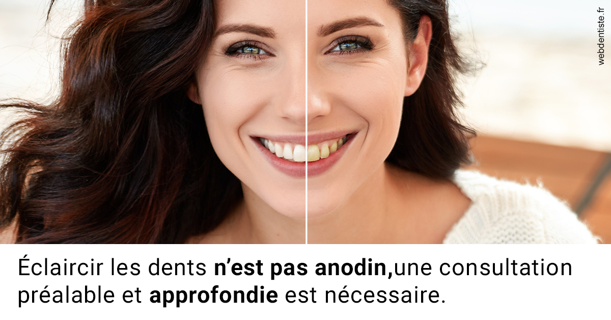 https://dr-bensoussan-jacques-yves.chirurgiens-dentistes.fr/Le blanchiment 2