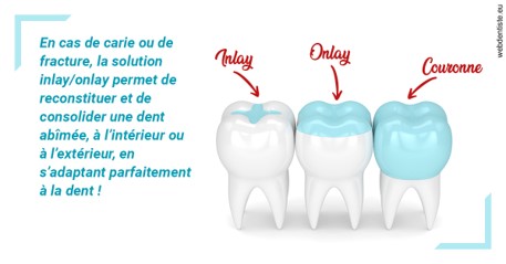 https://dr-bensoussan-jacques-yves.chirurgiens-dentistes.fr/L'INLAY ou l'ONLAY