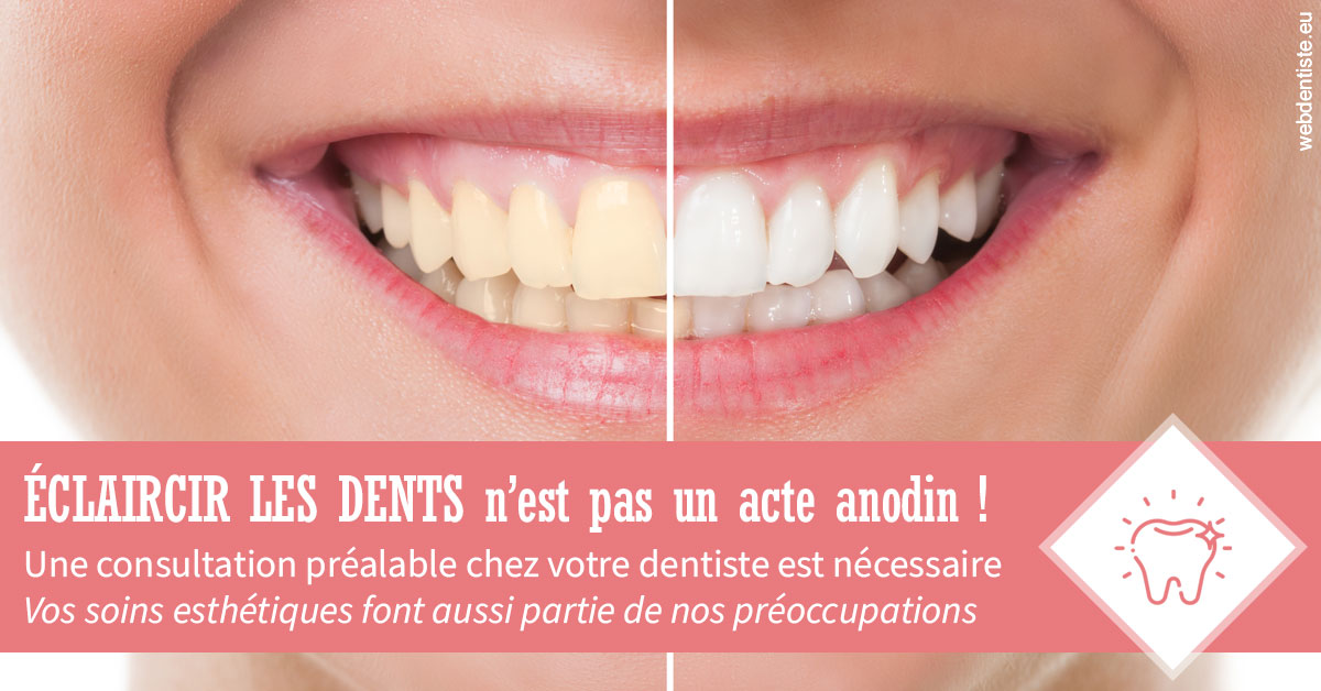https://dr-bensoussan-jacques-yves.chirurgiens-dentistes.fr/Eclaircir les dents 1