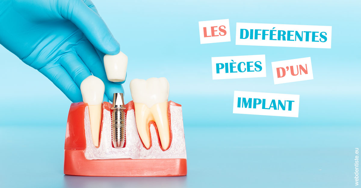 https://dr-bensoussan-jacques-yves.chirurgiens-dentistes.fr/Les différentes pièces d’un implant 2