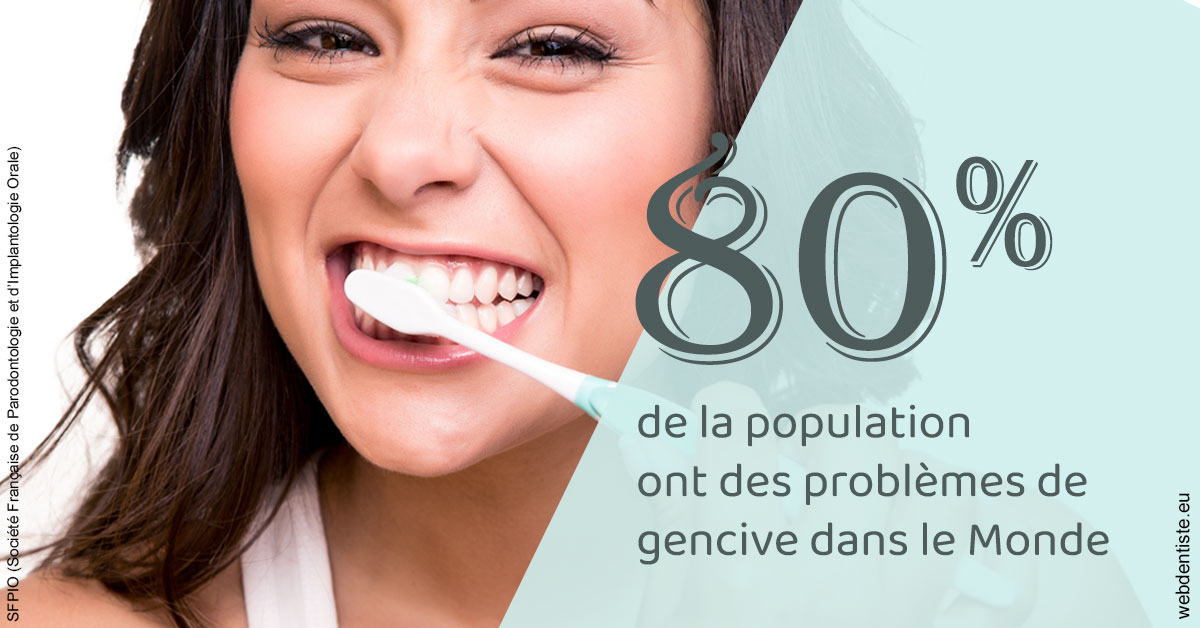 https://dr-bensoussan-jacques-yves.chirurgiens-dentistes.fr/Problèmes de gencive 1
