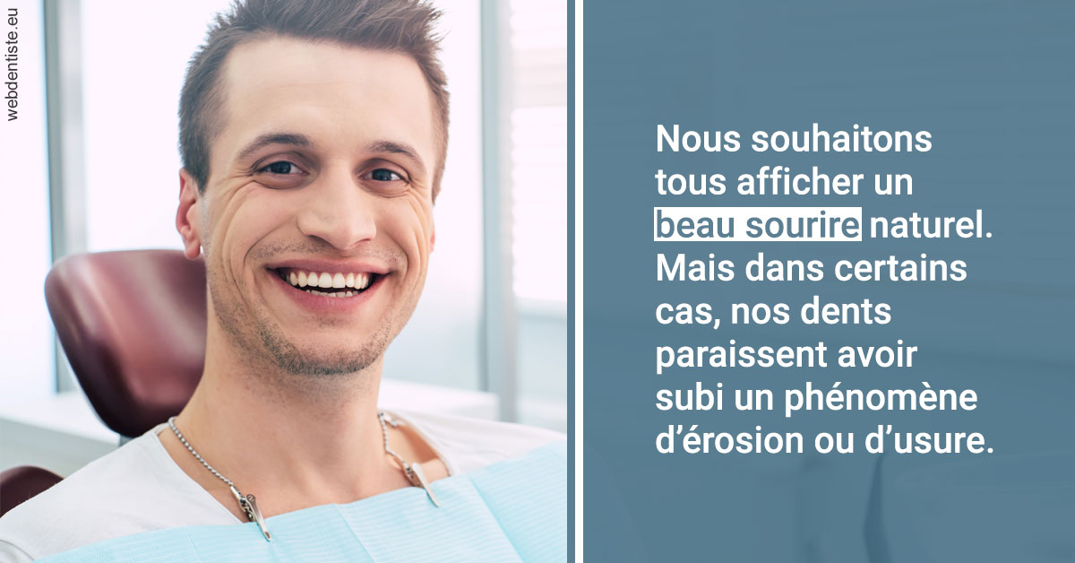 https://dr-bensoussan-jacques-yves.chirurgiens-dentistes.fr/Érosion et usure dentaire