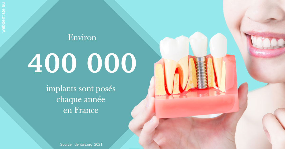 https://dr-bensoussan-jacques-yves.chirurgiens-dentistes.fr/Pose d'implants en France 2